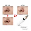 6-in-1-Multi-Functional-Blackheads-Removal-Machine